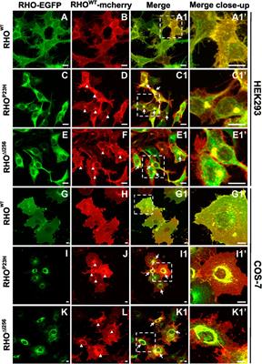 Mutant dominant-negative rhodopsin∆I256 causes protein aggregates degraded via ERAD and prevents normal rhodopsin from proper membrane trafficking